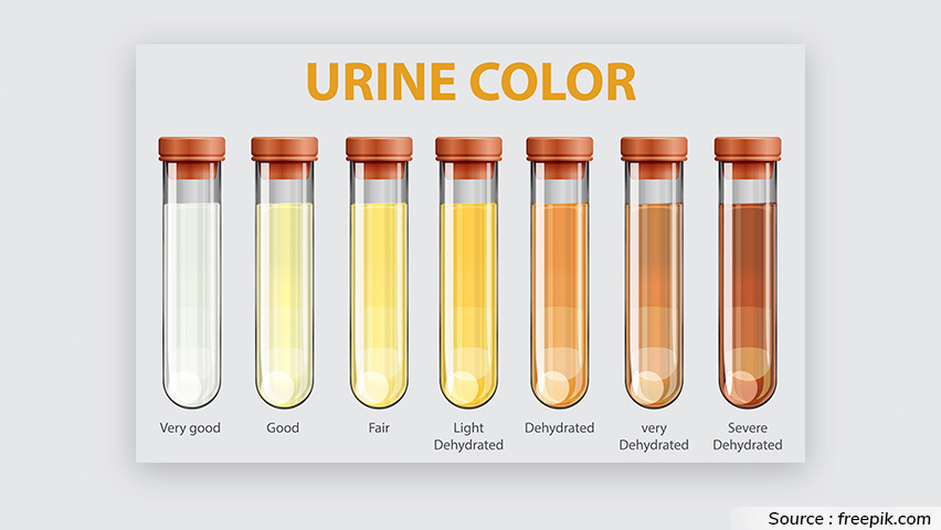 warna urin indikator suhu tubuh