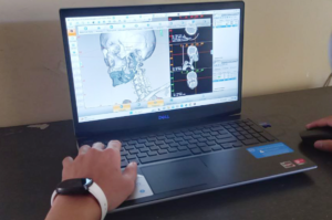 Proses pengolahan file 3D organ kepada dari hasil pemeriksaan MRI menggunakan software E3D karya Widya Imersif Teknologi.
